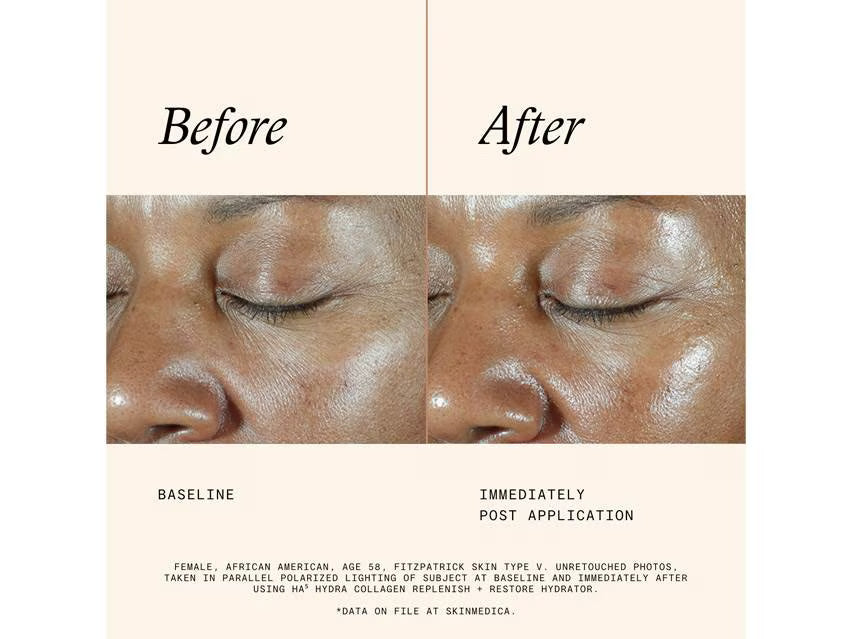 SkinMedica® HA⁵® Hydra Collagen Replenish + Restore Hydrator