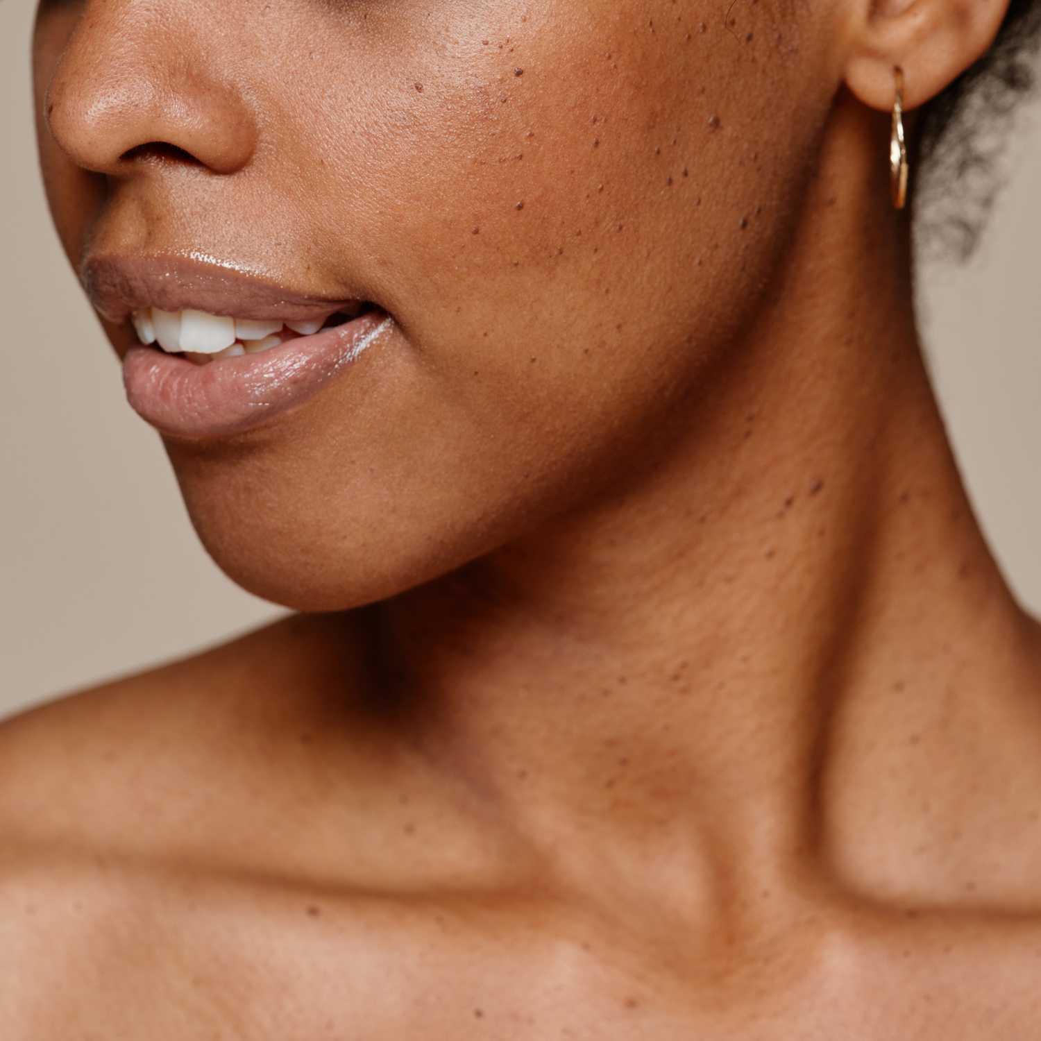 Oily Skin