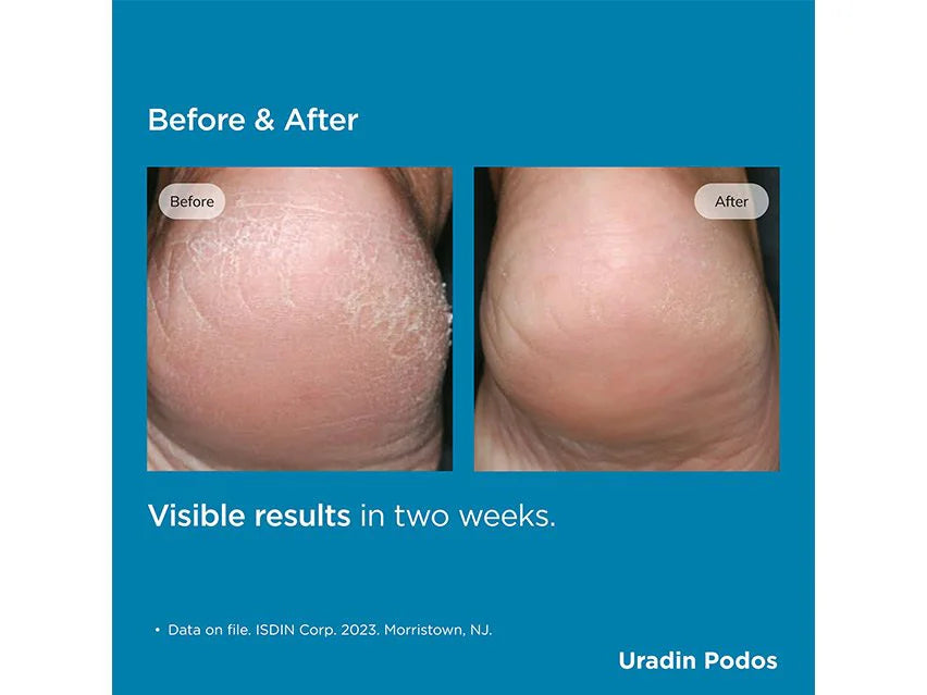 ISDIN Foot Care Uradin® Podos Hydrating Gel Oil