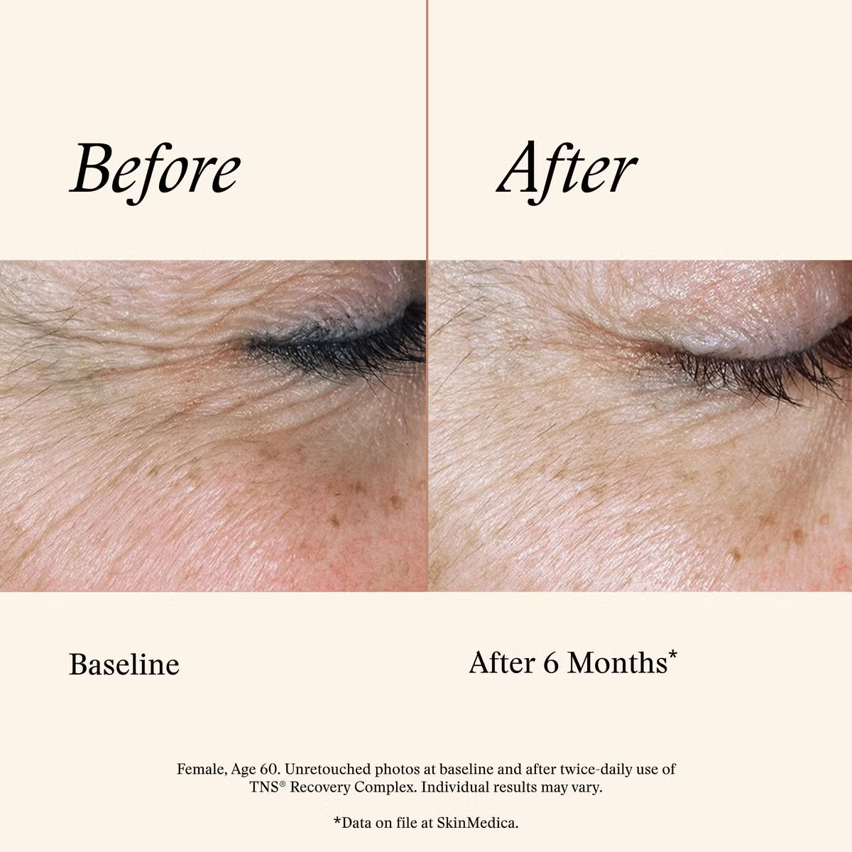 SkinMedica® TNS® Recovery Complex
